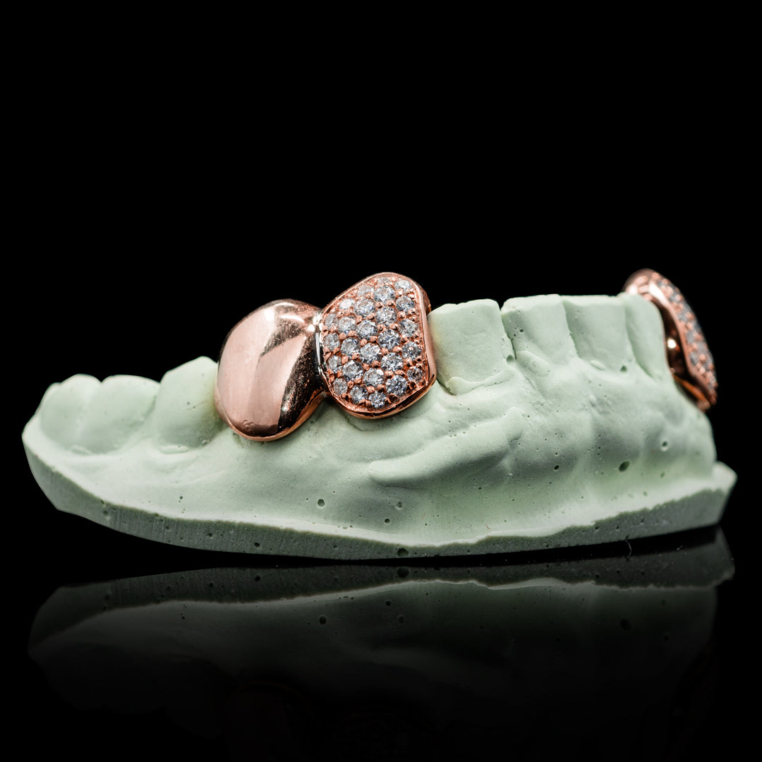 Solid and Iced Bottom Double Cap Grillz