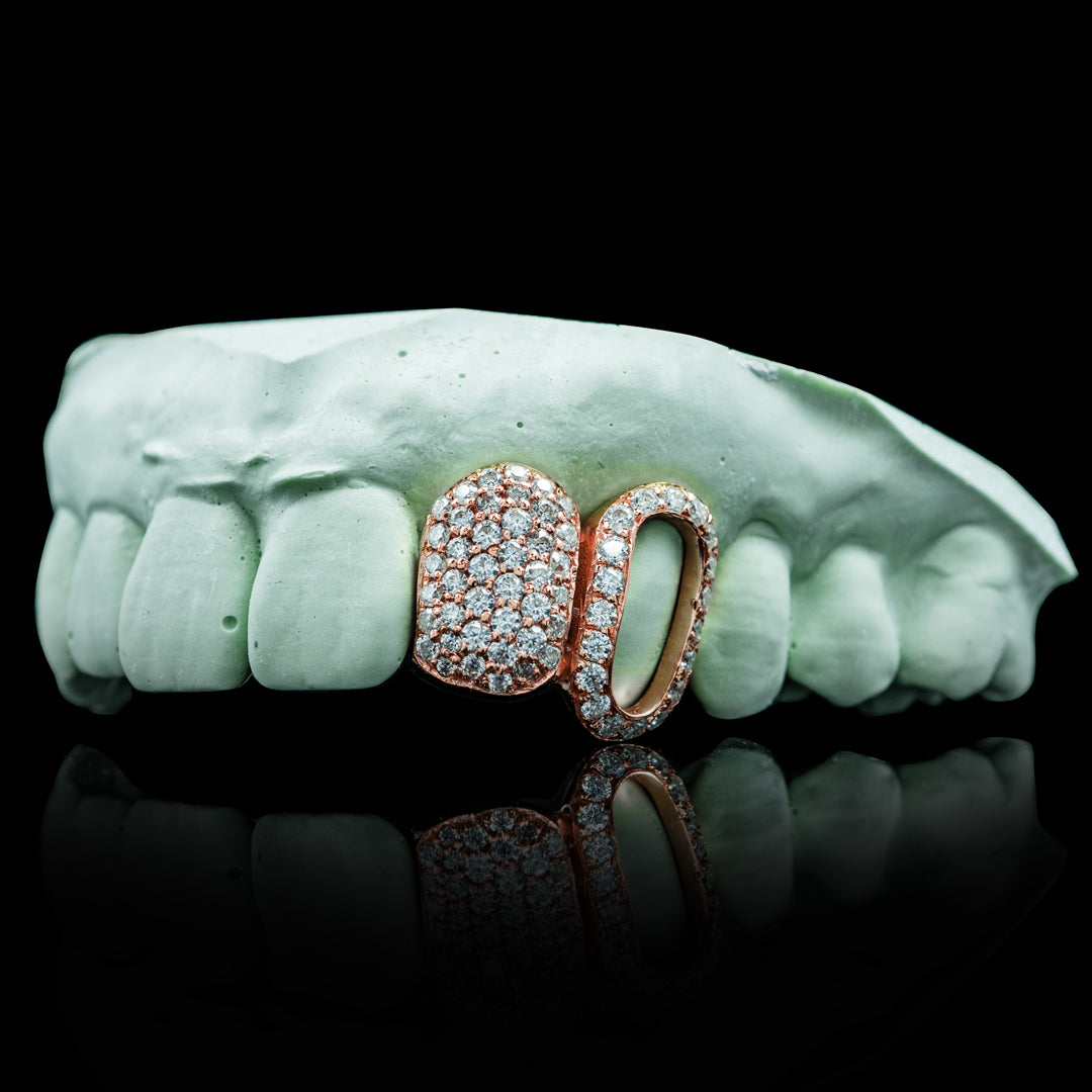 Iced Open Face Double Cap Grillz