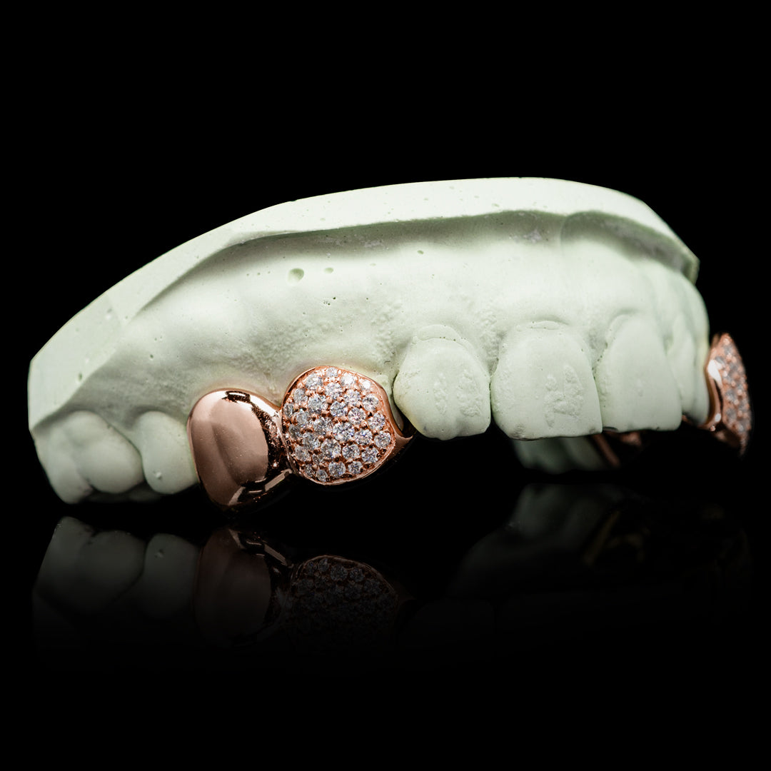 Solid and Iced Top Double Cap Grillz