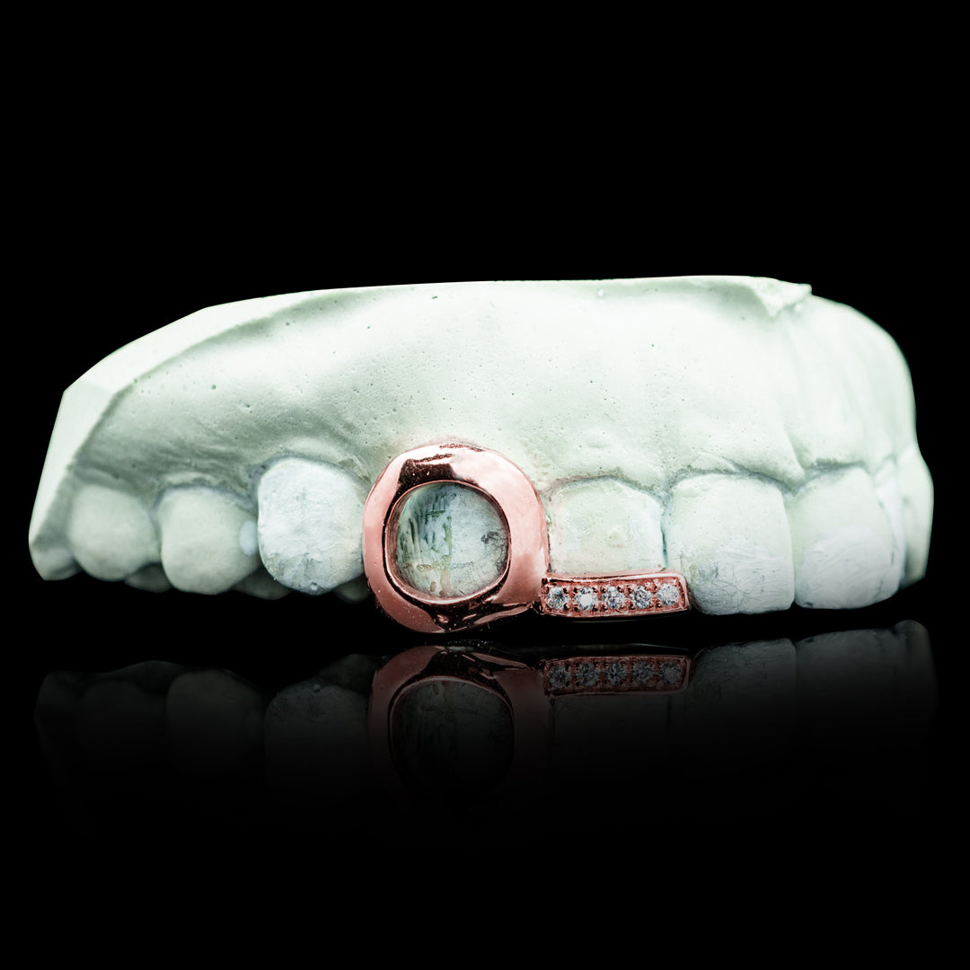 Open Face Iced Tip Double Cap Grillz