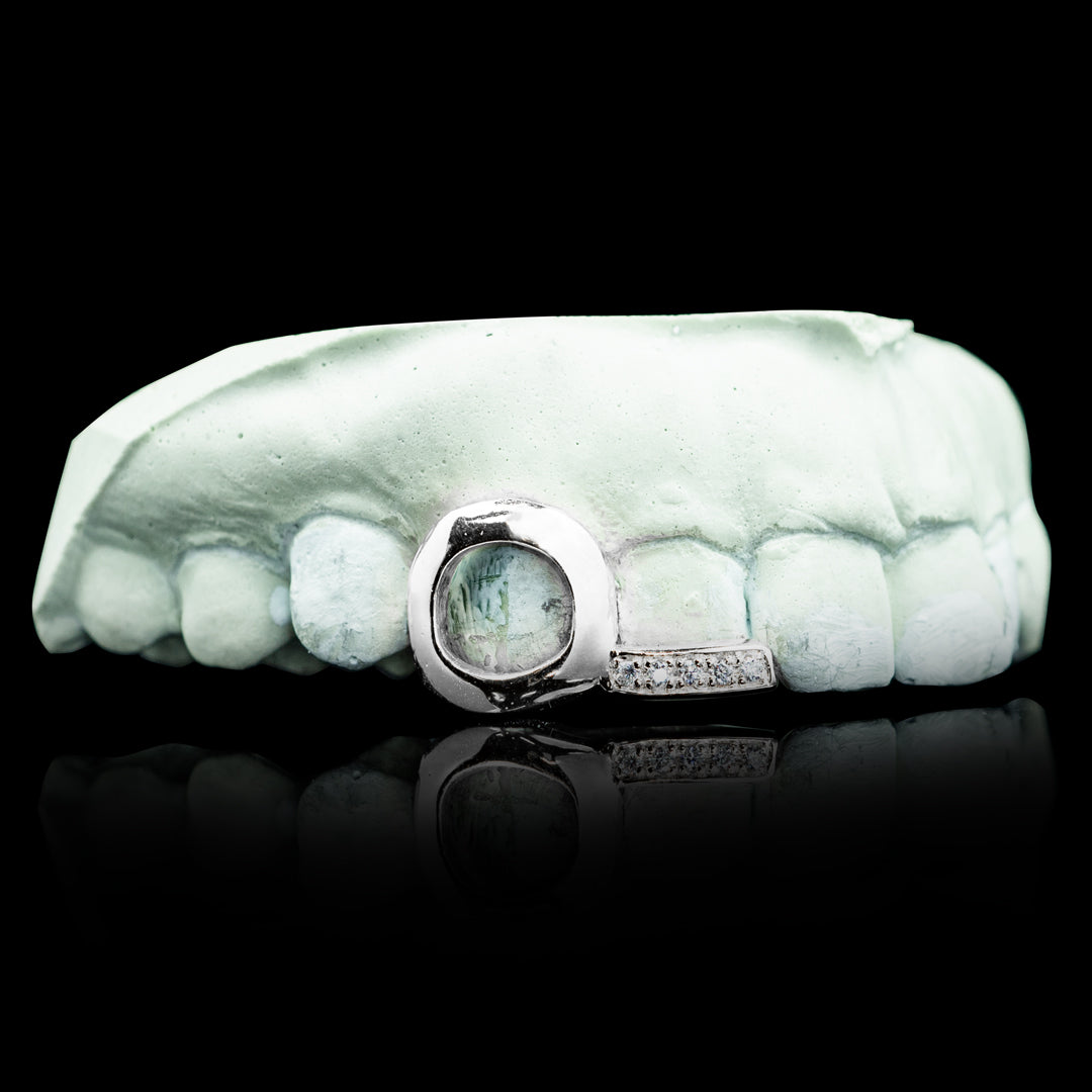 Open Face Iced Tip Double Cap Grillz