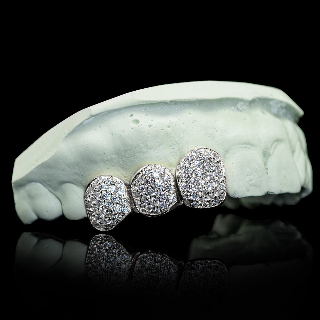 Iced Triple Cap VVS Moissanite Grillz