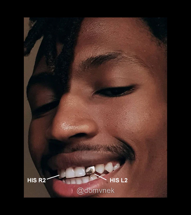 SOLID GOLD DOUBLE CAP TOOTH GRILLZ
