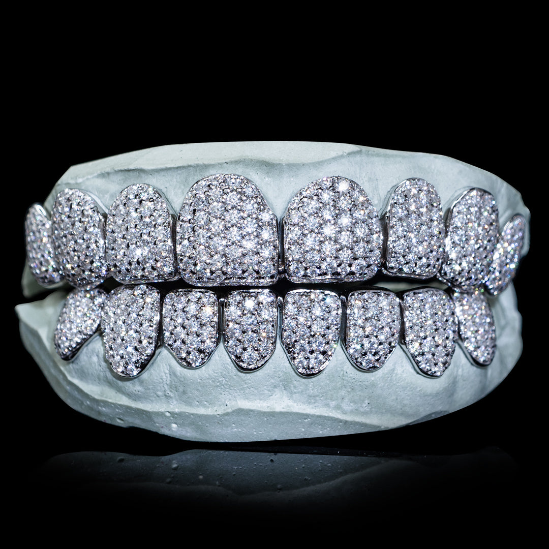 Iced VVS Moissanite Grillz (Zig Zag Setting)