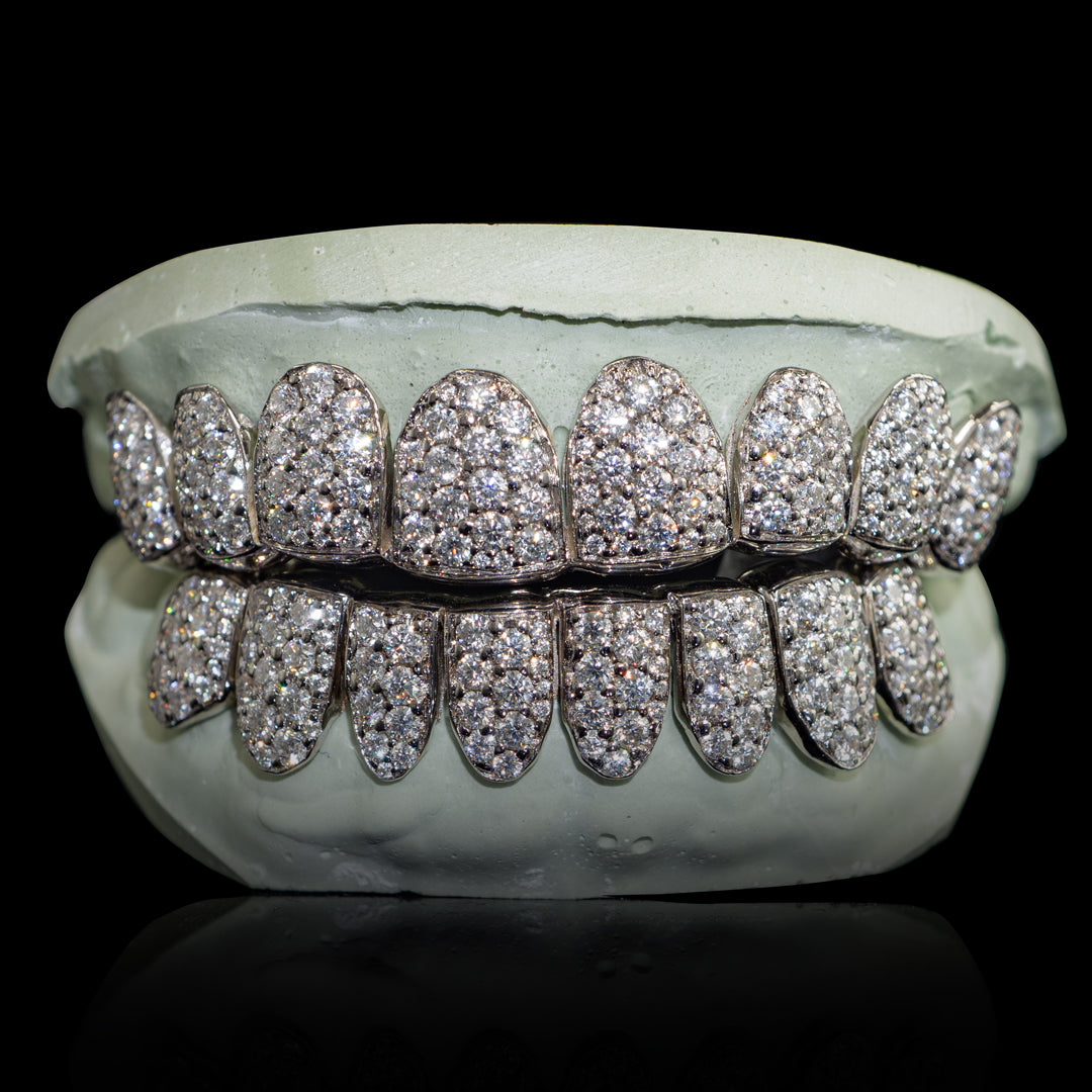 Iced VVS Moissanite Grillz with Large Moissanites (Zig Zag Setting)