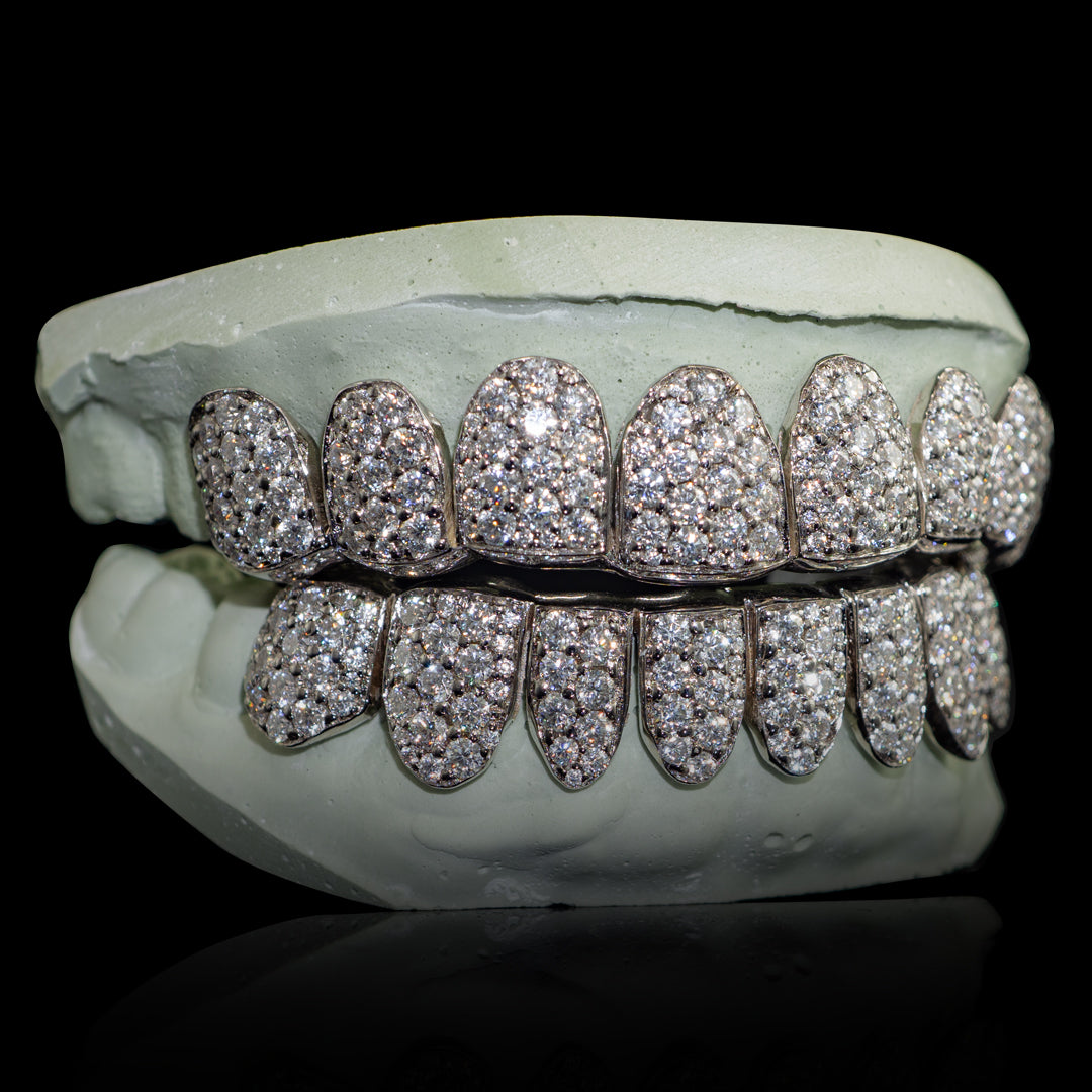 Iced VVS Moissanite Grillz with Large Moissanites (Zig Zag Setting)