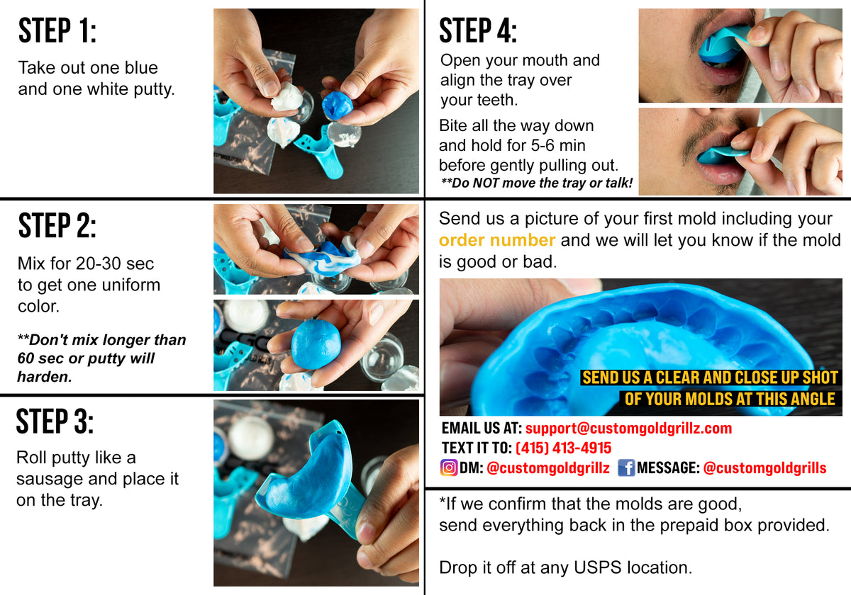 Replacement Molding Kit For Custom-Made Grillz