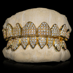 Fully Bustdown Iced Out Gold Grillz Custom Gold Grillz