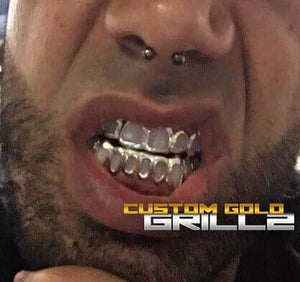 Solid Gold Open Face Custom-Made Grillz Worn by a Model