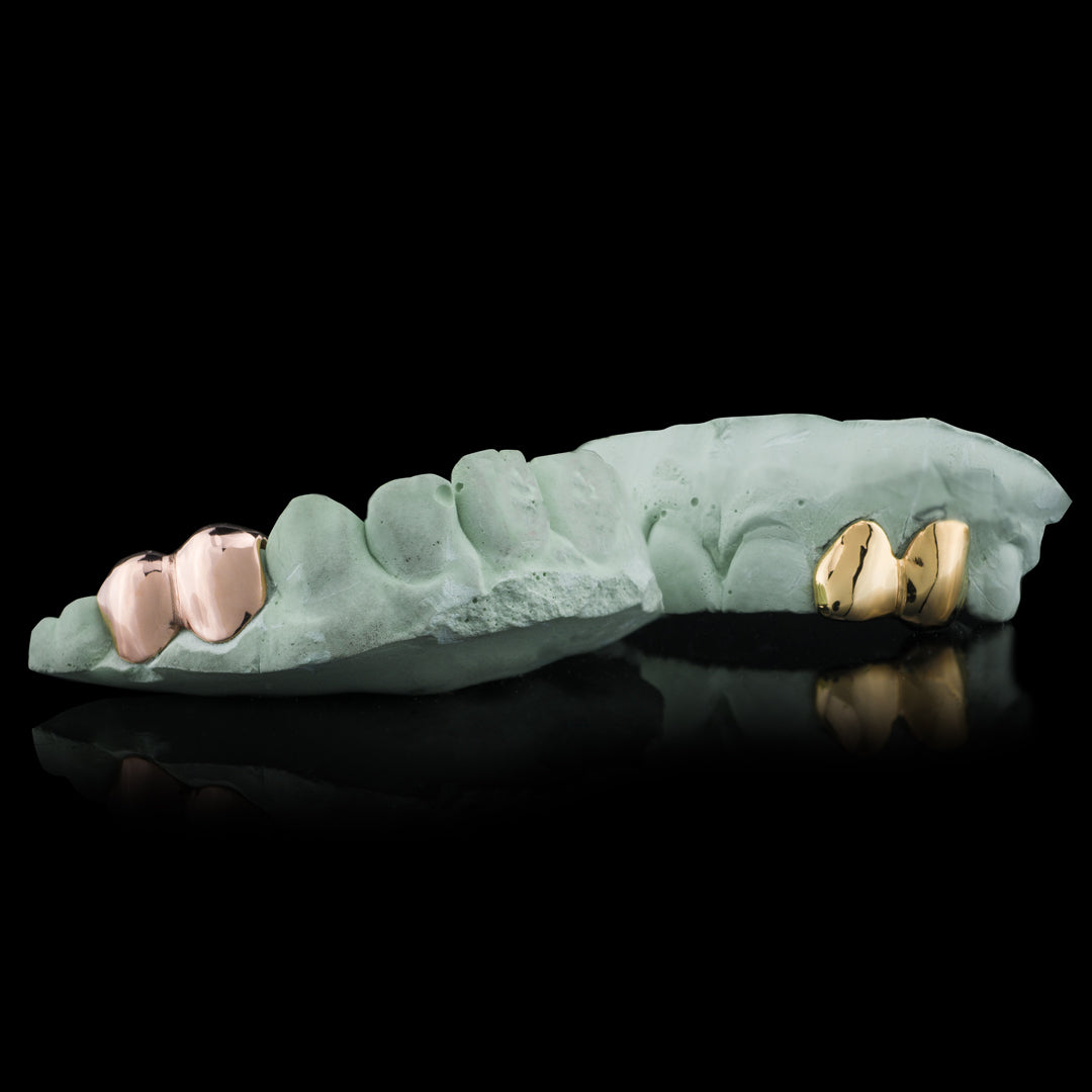 SOLID GOLD DOUBLE CAP TOOTH GRILLZ