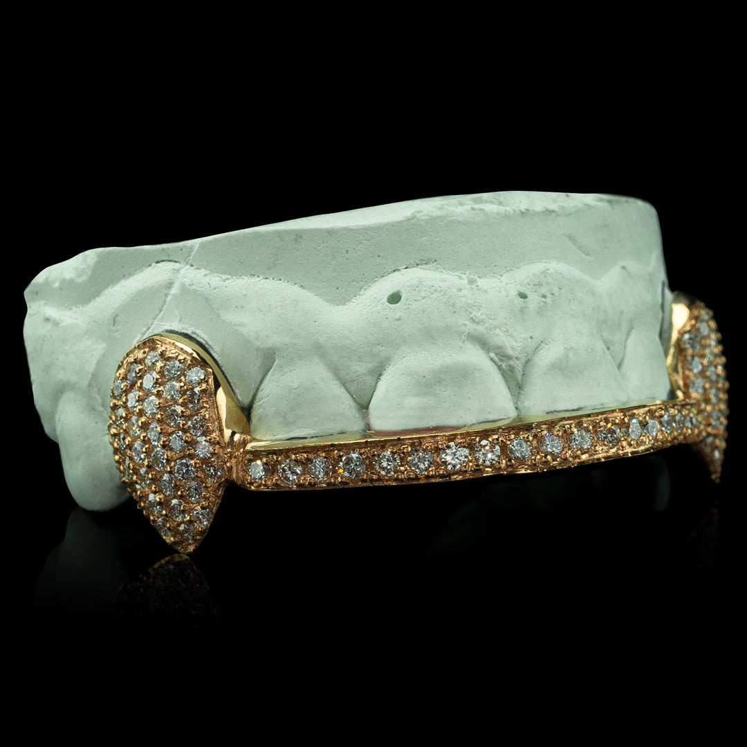 Shell Grill Bridge Solid and Iced Bridge Diamond Bar Grillz - Custom Gold Grillz
