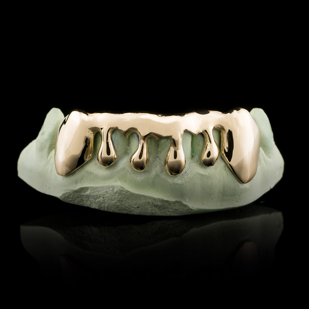 Solid Gold Drip Custom-Made Grillz Main