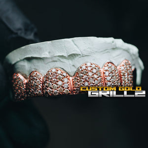 Solid .925 Sterling Silver Rose Gold Plating Iced Out Moissanite Diamonds Custom-Made Grillz
