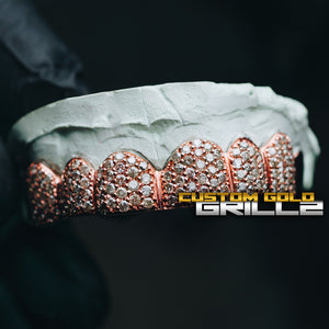 Solid .925 Sterling Silver Rose Gold Plating Iced Out CZ Diamonds Custom-Made Grillz