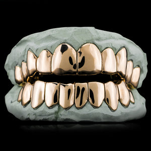 Solid Gold Custom-Made Grillz Main