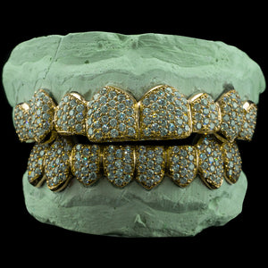 Fully Bustdown Iced Grillz (Zig Zag Setting)
