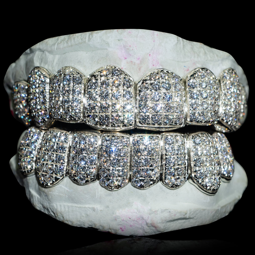 Custom Fully Iced Out VVS Moissanite Grillz (Straight) Custom Gold Grillz
