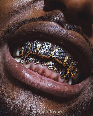 White Gold Grillz With Diamond Cuts & Dust - Custom Gold Grillz