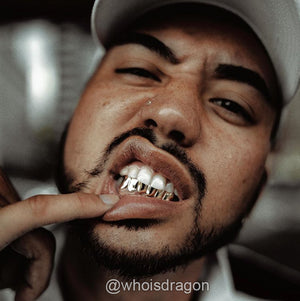 Solid Gold Grillz