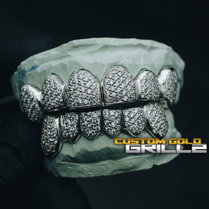 Fully Iced Out ZigZag Set with Moissanites Grillz